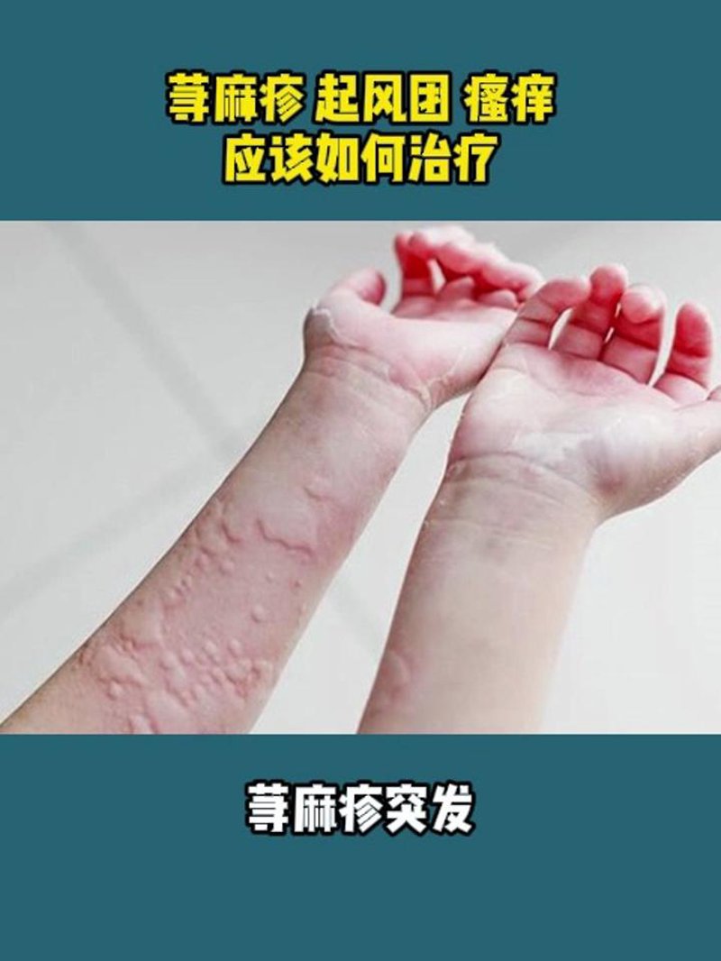 渭南皮肤病医院：揭开皮肤问题的神秘面纱