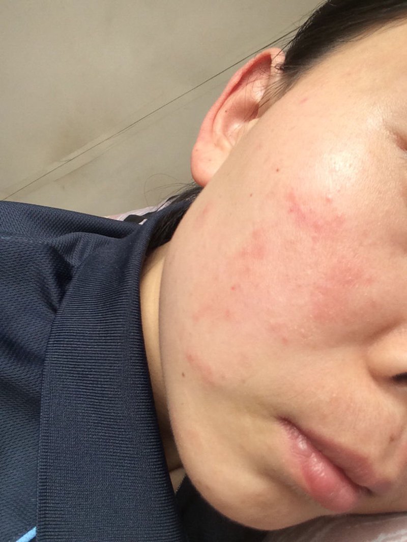 渭南皮肤病医院：引领城市皮肤健康守护之光