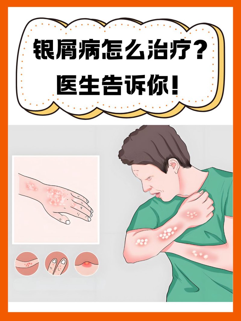 渭南皮肤病医院：关注健康的温馨港湾