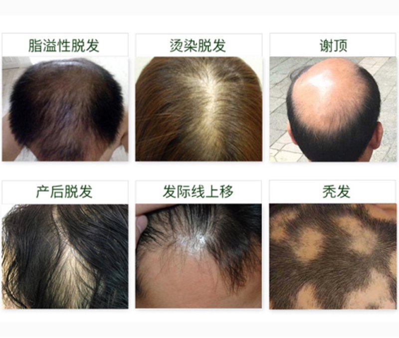 皮肤问题困扰你的生活？海成皮肤医院为您解析行业动态