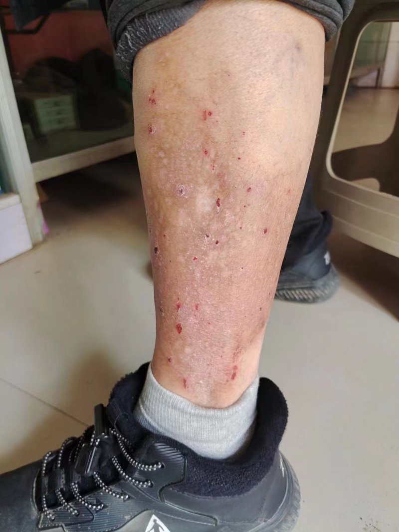 渭南皮肤专科医院：探寻皮肤健康的新篇章