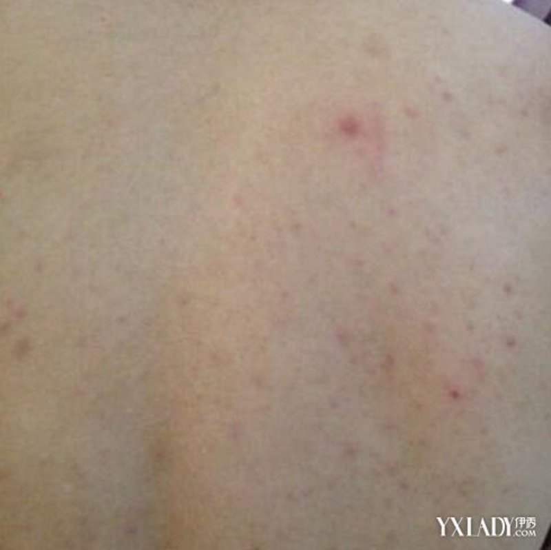 渭南皮肤病医院：寻找皮肤健康的守护者