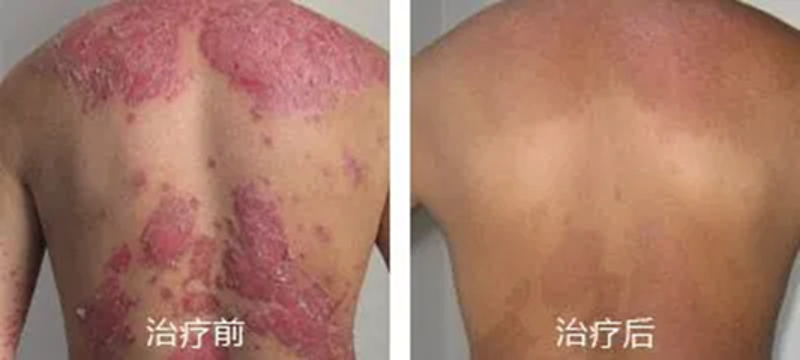 护肤新风尚：海成皮肤医院引领治疗与美容趋势