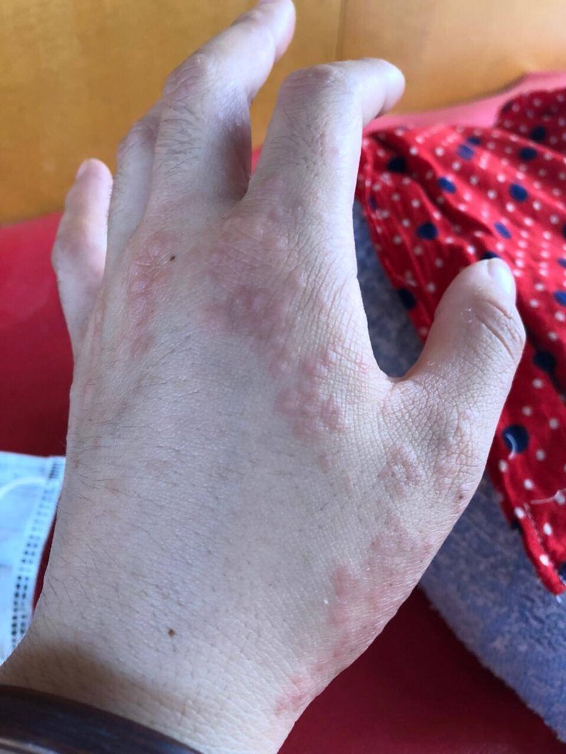 渭南皮肤病医院：为健康保驾护航